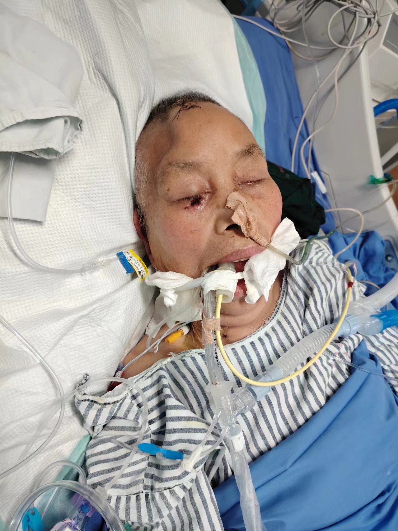 亚特兰大主帅尤里奇重病住院病情引发各界关注的简单介绍  第1张